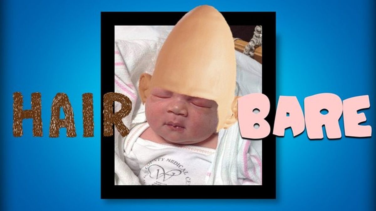 Babies: Hair or Bare? image number null